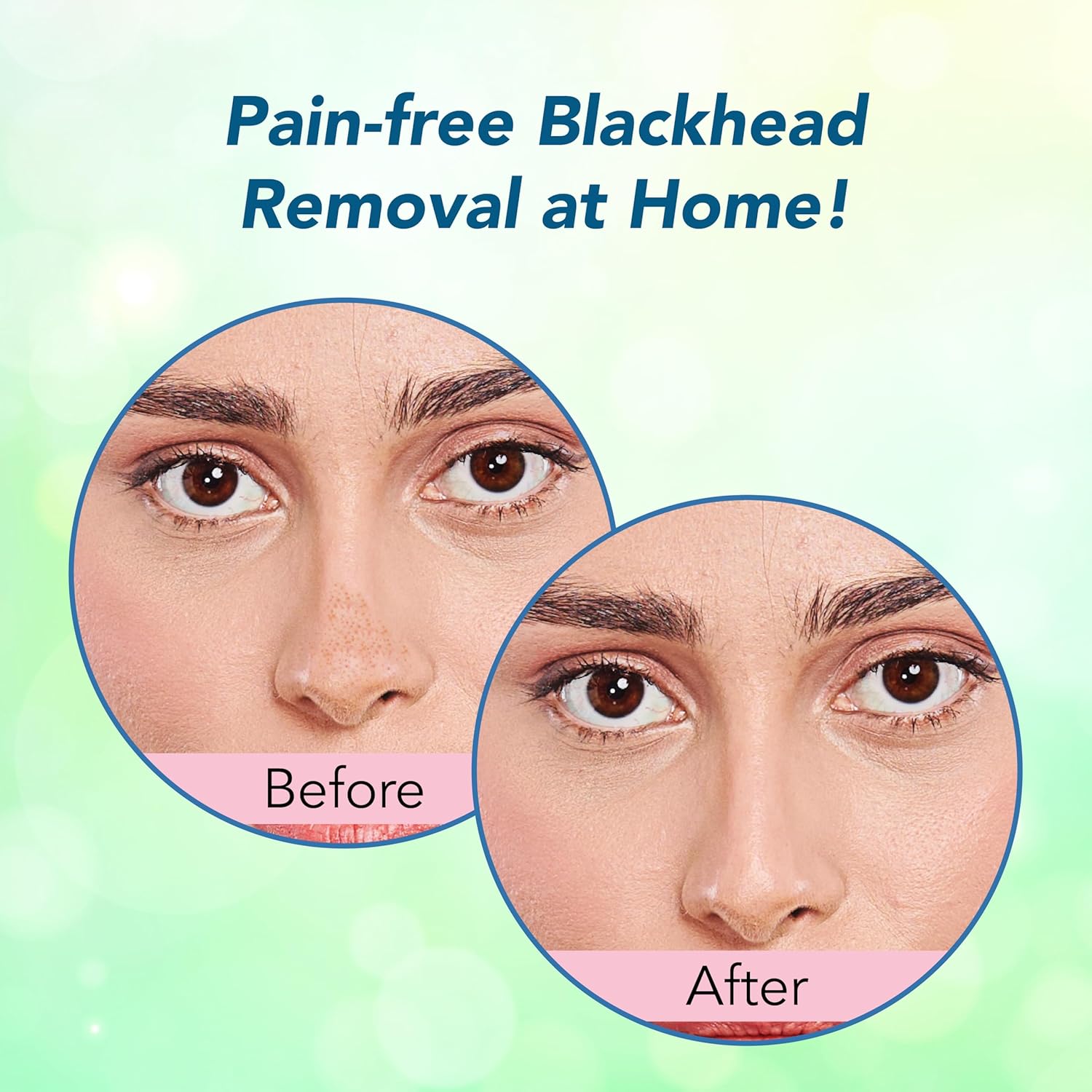 DR.RASHEL Korean Nose Pore Strips | With 1% ceramides and Rice Water| Deep Cleansing | Pore Tightening | Blackhead Removal | 10 Strips
