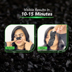 DR.Rashel Nose Pore Strips| Deep Cleansing Nose Strips For Instant And Painless Blackheads Removal 20 PCS (Bamboo Charcoal) (10 Strips &10 Wipes)