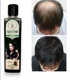 Soothi Herbals Handmade hair oil For hair fall and stronger hair 200ml